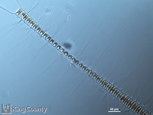Photo of Chaetoceros diadema